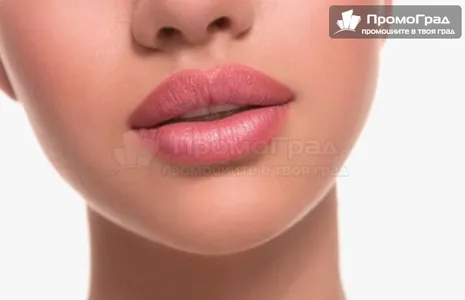 Поставяне на хиалуронов филър на лице Juvederm Ultra 3, 0.5 ml (устни, брадичка, скули, назолабиални, слепоочие)